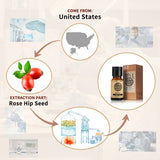 AKARZ Rose Hip Oil - Moisturizing Carrier Oil for Scar, Wrinkles & Stretch Marks - DIY Aroma Massage - 100%Pure & Natural – US