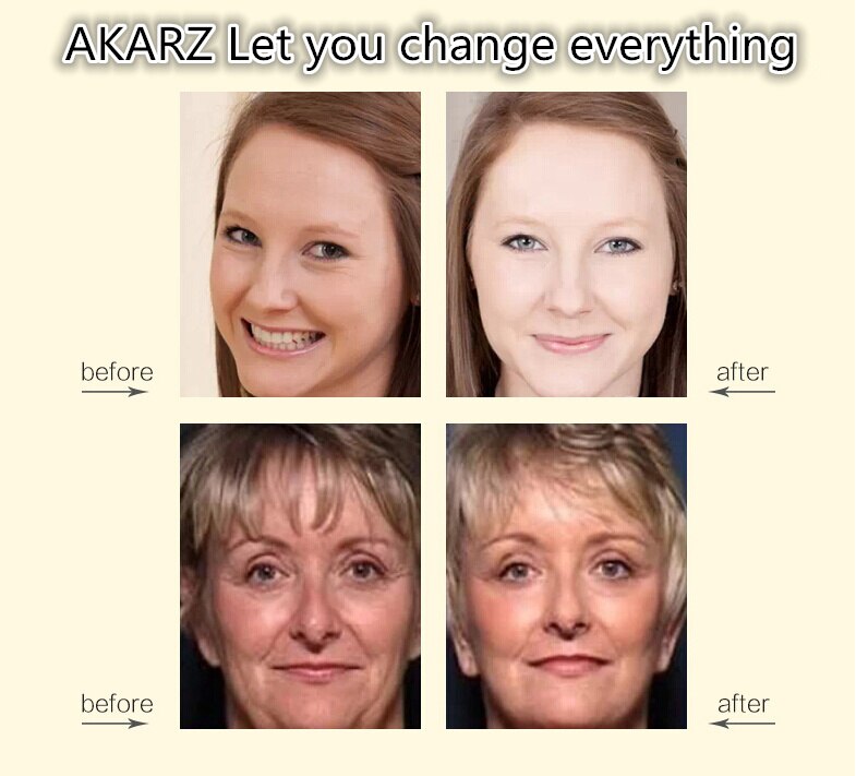 AKARZ Placenta Serum Moisturizing Cream Anti-Aging Algae Extract – Restore Youthful Glow with Brightening Placenta Essence