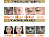 AKARZ Eye Care Serum - Reduce Wrinkles & Dark Circles, Relieve Tired Eyes - 10ml Essence Eye Care Serum