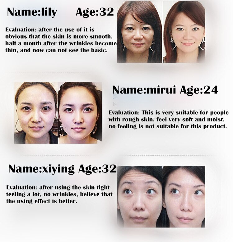 AKARZ Collagen Serum - Advanced Moisturizing and Whitening Solution for Firmer, Radiant Skin