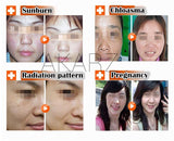 AKARZ Natural Whitening Serum - Brighten Skin, Spot Remover - 10ml Face Care Essence