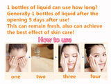 AKARZ Arbutin Serum Extract Essence Skin Lightening Moisturizer Whitening & Scar Remover
