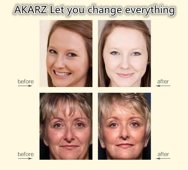 AKARZ placenta serum extrace essence moisturizing cream anti-aging ...